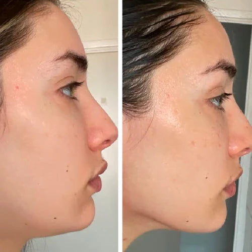 Lift Facial® - Cepillo Linfático Facial